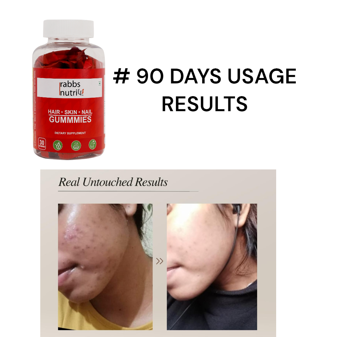 Rabbs Nutri (Hair Skin Nail Gummies)