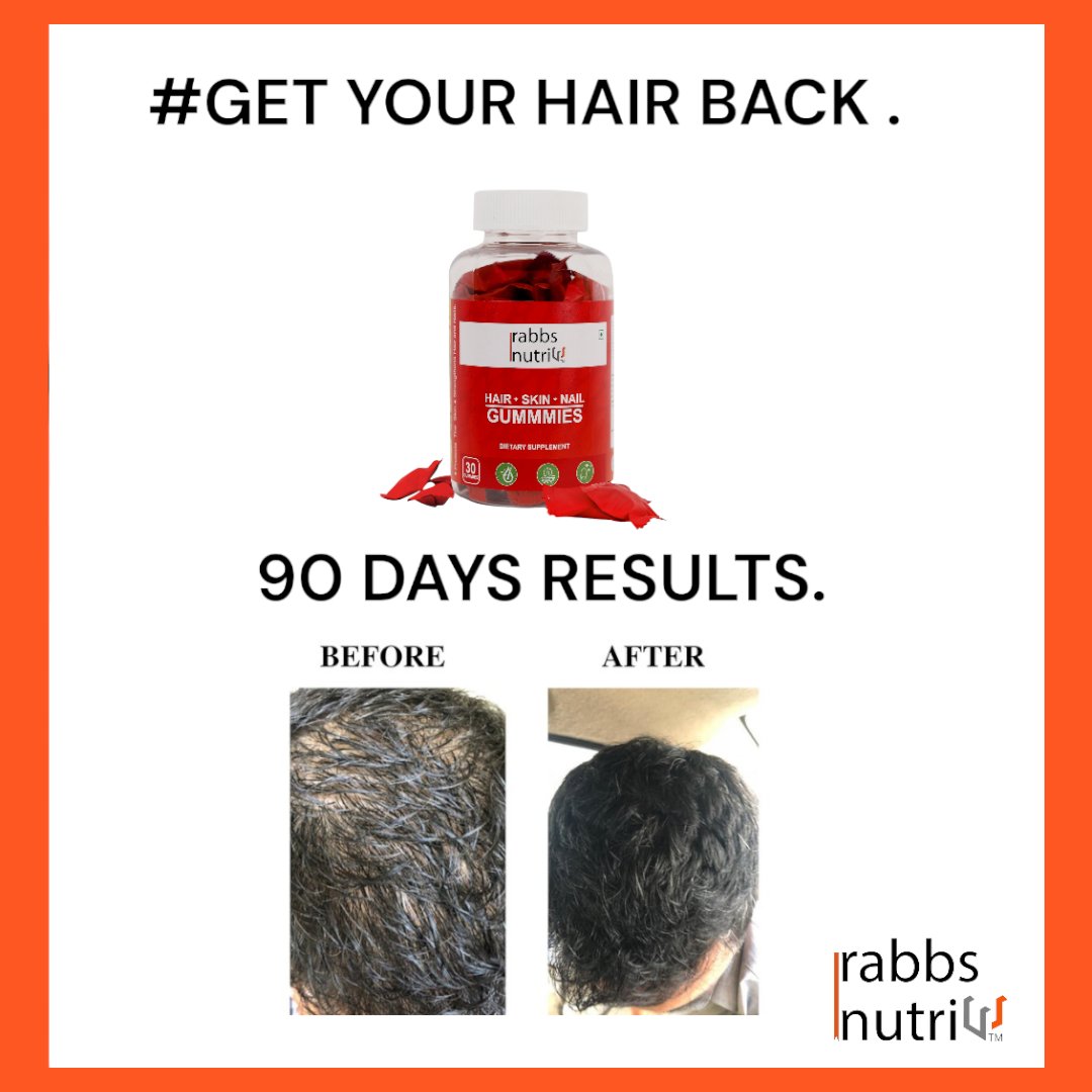 Rabbs Nutri (Hair Skin Nail Gummies)