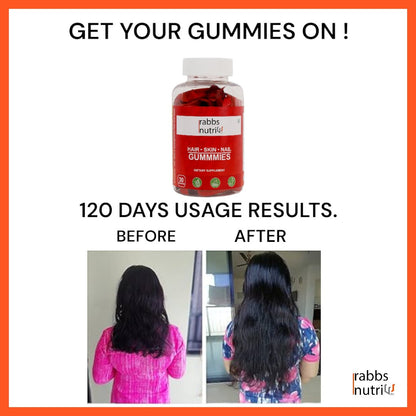 5.Gummies for Hair, Skin, Nail | 1 Solution for 3 Problems | 120 Gummies 41% Discount | Rabbs Nutri | COD avaialble